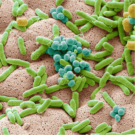 bacteria-on-kitchen-sponges